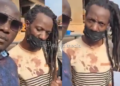 Kabaya alleges he lost four teeth after being abducted and assaulted.