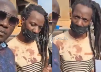 Kabaya alleges he lost four teeth after being abducted and assaulted.