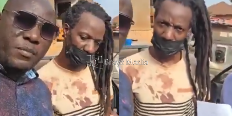 Kabaya alleges he lost four teeth after being abducted and assaulted.