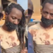 Kabaya alleges he lost four teeth after being abducted and assaulted.